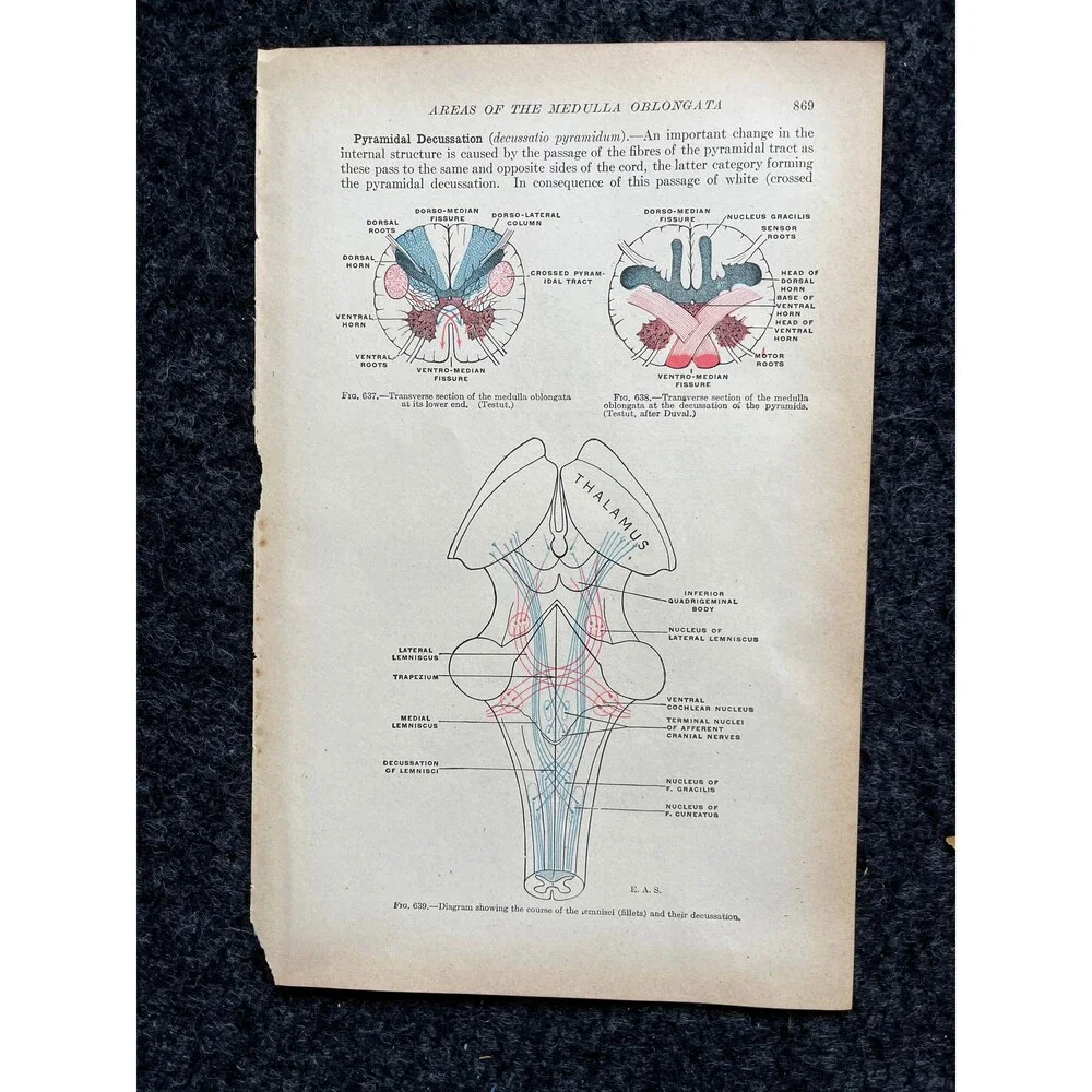 Original 1913 Anatomy Pages of Human Body, Anatomy Physiology Textbook Gifts, T